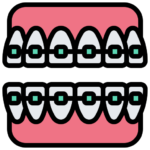 Braces