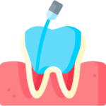 Root canal treatment